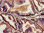 Immunohistochemistry of paraffin-embedded human prostate tissue using CAC13985 at dilution of 1:100