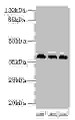 Western Blot, All lanes: HNRNPD antibody at 2ug/ml, Lane 1: 293T whole cell lysate, Lane 2: Hela whole cell lysate, Lane 3: Jurkat whole cell lysate, Secondary, Goat polyclonal to rabbit IgG at 1/10000 dilution, Predicted band size: 39, 37, 33, 31 kDa, Observed band size: 39 kDa