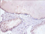 Immunohistochemistry of paraffin-embedded human prostate tissue using CAC13988 at dilution of 1:100