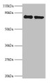 Western Blot, All lanes: RPS10 antibody at 2ug/ml, Lane 1: EC109 whole cell lysate, Lane 2: 293T whole cell lysate, Secondary, Goat polyclonal to rabbit IgG at 1/15000 dilution, Predicted band size: 19 kDa, Observed band size: 80 kDa