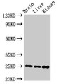 Western Blot, Positive WB detected in: Mouse brain tissue, Mouse liver tissue, Mouse kidney tissue, All lanes: VAMP7 antibody at 2ug/ml, Secondary, Goat polyclonal to rabbit IgG at 1/50000 dilution, Predicted band size: 25, 31, 21 kDa, Observed band size: 25 kDa