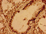 Immunohistochemistry of paraffin-embedded human lung tissue using CAC13995 at dilution of 1:100