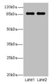 Western Blot, All lanes: VWA5A antibody at 1ug/ml, Lane 1: A549 whole cell lysate, Lane 2: MCF-7 whole cell lysate, Secondary, Goat polyclonal to rabbit IgG at 1/10000 dilution, Predicted band size: 87, 48, 46, 30 kDa, Observed band size: 87 kDa
