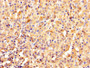 IHC image of CAC14002 diluted at 1:1000 and staining in paraffin-embedded human adrenal gland tissue performed on a Leica BondTM system. After dewaxing and hydration, antigen retrieval was mediated by high pressure in a citrate buffer (pH 6.0). Section was blocked with 10% normal goat serum 30min at RT. Then primary antibody (1% BSA) was incubated at 4°C overnight. The primary is detected by a biotinylated secondary antibody and visualized using an HRP conjugated SP system.
