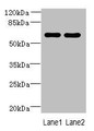 Western Blot, All lanes: ZNF215 antibody at 3ug/ml, Lane 1: Hela whole cell lysate, Lane 2: A431 whole cell lysate, Secondary, Goat polyclonal to rabbit IgG at 1/10000 dilution, Predicted band size: 61, 36 kDa, Observed band size: 61 kDa