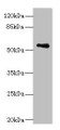 Western Blot, All lanes: ZSCAN32 antibody at 1ug/ml + MCF-7 whole cell lysate, Secondary, Goat polyclonal to rabbit IgG at 1/10000 dilution, Predicted band size: 79, 55, 47 kDa, Observed band size: 55 kDa