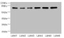 Western Blot, All lanes: ZNF555 antibody at 2ug/ml, Lane 1: HepG2 whole cell lysate, Lane 2: 293T whole cell lysate, Lane 3: Hela whole cell lysate, Lane 4: Jurkat whole cell lysate, Lane 5: Mouse liver tissue, Lane 6: HL60 whole cell lysate, Secondary, Goat polyclonal to rabbit IgG at 1/10000 dilution, Predicted band size: 74, 64, 73 kDa, Observed band size: 74 kDa