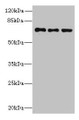 Western Blot, All lanes: ZNF614 antibody at 6ug/ml, Lane 1: Jurkat whole cell lysate, Lane 2: HepG2 whole cell lysate, Lane 3: A549 whole cell lysate, Secondary, Goat polyclonal to rabbit IgG at 1/10000 dilution, Predicted band size: 68, 23 kDa, Observed band size: 68 kDa Western Blot, All lanes: ZNF614 antibody at 6ug/ml, Lane 1: Jurkat whole cell lysate, Lane 2: HepG2 whole cell lysate, Lane 3: A549 whole cell lysate, Secondary, Goat polyclonal to rabbit IgG at 1/10000 dilution, Predicted band size: 68, 23 kDa, Observed band size: 68 kDa