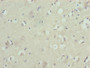 Immunohistochemistry of paraffin-embedded human brain tissue using CAC14025 at dilution of 1:100