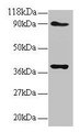Western Blot, All lanes: NDUFS5 antibody at 2ug/ml, Lane 1: EC109 whole cell lysate, Lane 2: 293T whole cell lysate, Secondary, Goat polyclonal to rabbit IgG at 1/15000 dilution, Predicted band size: 13 kDa, Observed band size: 40 kDa