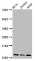 Western Blot, Positive WB detected in: Hela whole cell lysate, Jurkat whole cell lysate, A549 whole cell lysate, All lanes: TXN antibody at 3ug/ml, Secondary, Goat polyclonal to rabbit IgG at 1/50000 dilution, Predicted band size: 12, 10 kDa, Observed band size: 12 kDa Western Blot, Positive WB detected in: Hela whole cell lysate, Jurkat whole cell lysate, A549 whole cell lysate, All lanes: TXN antibody at 3ug/ml, Secondary, Goat polyclonal to rabbit IgG at 1/50000 dilution, Predicted band size: 12, 10 kDa, Observed band size: 12 kDa