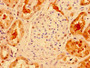 IHC image of CAC14030 diluted at 1:300 and staining in paraffin-embedded human kidney tissue performed on a Leica BondTM system. After dewaxing and hydration, antigen retrieval was mediated by high pressure in a citrate buffer (pH 6.0). Section was blocked with 10% normal goat serum 30min at RT. Then primary antibody (1% BSA) was incubated at 4°C overnight. The primary is detected by a biotinylated secondary antibody and visualized using an HRP conjugated SP system. IHC image of CAC14030 diluted at 1:300 and staining in paraffin-embedded human kidney tissue performed on a Leica BondTM system. After dewaxing and hydration, antigen retrieval was mediated by high pressure in a citrate buffer (pH 6.0). Section was blocked with 10% normal goat serum 30min at RT. Then primary antibody (1% BSA) was incubated at 4°C overnight. The primary is detected by a biotinylated secondary antibody and visualized using an HRP conjugated SP system.
