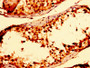 IHC image of CAC14030 diluted at 1:300 and staining in paraffin-embedded human testis tissue performed on a Leica BondTM system. After dewaxing and hydration, antigen retrieval was mediated by high pressure in a citrate buffer (pH 6.0). Section was blocked with 10% normal goat serum 30min at RT. Then primary antibody (1% BSA) was incubated at 4°C overnight. The primary is detected by a biotinylated secondary antibody and visualized using an HRP conjugated SP system. IHC image of CAC14030 diluted at 1:300 and staining in paraffin-embedded human testis tissue performed on a Leica BondTM system. After dewaxing and hydration, antigen retrieval was mediated by high pressure in a citrate buffer (pH 6.0). Section was blocked with 10% normal goat serum 30min at RT. Then primary antibody (1% BSA) was incubated at 4°C overnight. The primary is detected by a biotinylated secondary antibody and visualized using an HRP conjugated SP system.