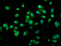 Immunofluorescence staining of Hela cells with CAC14030 at 1:100, counter-stained with DAPI. The cells were fixed in 4% formaldehyde, permeabilized using 0.2% Triton X-100 and blocked in 10% normal Goat Serum. The cells were then incubated with the antibody overnight at 4°C. The secondary antibody was Alexa Fluor 488-congugated AffiniPure Goat Anti-Rabbit IgG(H+L). Immunofluorescence staining of Hela cells with CAC14030 at 1:100, counter-stained with DAPI. The cells were fixed in 4% formaldehyde, permeabilized using 0.2% Triton X-100 and blocked in 10% normal Goat Serum. The cells were then incubated with the antibody overnight at 4°C. The secondary antibody was Alexa Fluor 488-congugated AffiniPure Goat Anti-Rabbit IgG(H+L).