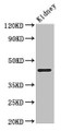Western Blot, Positive WB detected in: Mouse kidney tissue, All lanes: PRMT1 antibody at 2.5ug/ml, Secondary, Goat polyclonal to rabbit IgG at 1/50000 dilution, Predicted band size: 43, 40, 41, 33 kDa, Observed band size: 43 kDa