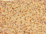 Immunohistochemistry of paraffin-embedded human adrenal gland tissue using CAC14032 at dilution of 1:100