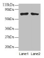 Western Blot, All lanes: BMI1 antibodyt 2ug/ml, Lane 1: EC109 whole cell lysate, Lane 2: 293T whole cell lysate, Secondary, Goat polyclonal to rabbit IgG at 1/15000 dilution, Predicted band size: 37 kDa, Observed band size: 70 kDa Western Blot, All lanes: BMI1 antibodyt 2ug/ml, Lane 1: EC109 whole cell lysate, Lane 2: 293T whole cell lysate, Secondary, Goat polyclonal to rabbit IgG at 1/15000 dilution, Predicted band size: 37 kDa, Observed band size: 70 kDa