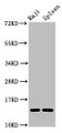 Western Blot, Positive WB detected in: Raji whole cell lysate, Rat spleen tissue, All lanes: GABARAPL2 antibody at 4ug/ml, Secondary, Goat polyclonal to rabbit IgG at 1/50000 dilution, Predicted band size: 14 kDa, Observed band size: 14 kDa