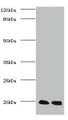 Western Blot, All lanes: Protein DJ-1 antibody at 2ug/ml, Lane 1: EC109 whole cell lysate, Lane 2: 293T whole cell lysate, Secondary, Goat polyclonal to Rabbit IgG at 1/15000 dilution, Predicted band size: 20 kDa, Observed band size: 20 kDa