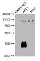 Immunoprecipitating ABL1 in Hela whole cell lysate, Lane 1: Rabbit control IgG (1ug) instead of CAC14060 in Hela whole cell lysate. For western blotting, a HRP-conjugated Protein G antibody was used as the secondary antibody (1/2000), Lane 2: CAC14060 (6ug) + Hela whole cell lysate (500ug), Lane 3: Hela whole cell lysate (10ug)