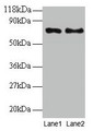 Western Blot, All lanes: TAX1BP3 antibody at 2ug/ml, Lane 1: EC109 whole cell lysate, Lane 2: 293T whole cell lysate, Secondary, Goat polyclonal to rabbit IgG at 1/15000 dilution, Predicted band size: 14 kDa, Observed band size: 70 kDa