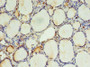 Immunohistochemistry of paraffin-embedded human thyroid tissue using CAC14062 at dilution of 1:100