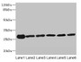Western Blot, All lanes: TMED9 antibody at 4.5ug/ml, Lane 1: Mouse liver tissue, Lane 2: Mouse kidney tissue, Lane 3: Human placenta tissue, Lane 4: A549 whole cell lysate, Lane 5: MCF-7 whole cell lysate, Lane 6: A431 whole cell lysate, Secondary, Goat polyclonal to rabbit IgG at 1/10000 dilution, Predicted band size: 28 kDa, Observed band size: 28 kDa