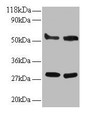 Western Blot, All lanes: ERP29 antibody at 2ug/ml, Lane 1: EC109 whole cell lysate, Lane 2: 293T whole cell lysate, Secondary, Goat polyclonal to rabbit IgG at 1/15000 dilution, Predicted band size: 29, 6 kDa, Observed band size: 29, 55 kDa