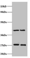 Western Blot, All lanes: NDUFV2 antibody at 2ug/ml, Lane 1: EC109 whole cell lysate, Lane 2: 293T whole cell lysate, Secondary, Goat polyclonal to rabbit IgG at 1/15000 dilution, Predicted band size: 28 kDa, Observed band size: 28 kDa