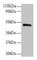 Western Blot, All lanes: PICK1 antibody at 2ug/ml + Mouse brain tissue, Secondary, Goat polyclonal to rabbit IgG at 1/10000 dilution, Predicted band size: 47, 40 kDa, Observed band size: 47 kDa Western Blot, All lanes: PICK1 antibody at 2ug/ml + Mouse brain tissue, Secondary, Goat polyclonal to rabbit IgG at 1/10000 dilution, Predicted band size: 47, 40 kDa, Observed band size: 47 kDa