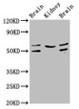 Western Blot, Positive WB detected in: Rat brain tissue, Rat kidney tissue, Mouse brain tissue, All lanes: ANGPT2 antibody at 3.2ug/ml, Secondary, Goat polyclonal to rabbit IgG at 1/50000 dilution, Predicted band size: 57, 51 kDa, Observed band size: 57, 51 kDa