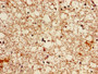Immunohistochemistry of paraffin-embedded human brain tissue using CAC14083 at dilution of 1:100