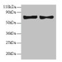 Western Blot, All lanes: CCL5 antibody at 2ug/ml, Lane 1: EC109 whole cell lysate, Lane 2: 293T whole cell lysate, Secondary, Goat polyclonal to rabbit IgG at 1/15000 dilution, Predicted band size: 10 kDa, Observed band size: 70 kDa