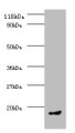 Western Blot, All lanes: CCL5 antibody at 2ug/ml + PMBC whole cell lysate, Secondary, Goat polyclonal to rabbit IgG at 1/10000 dilution, Predicted band size: 10 kDa, Observed band size: 10 kDa