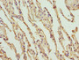 Immunohistochemistry of paraffin-embedded human lung tissue using CAC14091 at dilution of 1:100