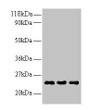 Western Blot, All lanes: LCN2 antibody at 2ug/ml, Lane 1: Human positive serum at 1: 10, Lane 2: Human positive serum at 1: 100, Lane 3: Human positive serum at 1: 500, Secondary, Goat polyclonal to rabbit IgG at 1/15000 dilution, Predicted band size: 23 kDa, Observed band size: 23 kDa Western Blot, All lanes: LCN2 antibody at 2ug/ml, Lane 1: Human positive serum at 1: 10, Lane 2: Human positive serum at 1: 100, Lane 3: Human positive serum at 1: 500, Secondary, Goat polyclonal to rabbit IgG at 1/15000 dilution, Predicted band size: 23 kDa, Observed band size: 23 kDa