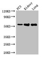 Western Blot, Positive WB detected in: PC-3 whole cell lysate, Mouse kidney tissue, Mouse lung tissue, All lanes: MMP13 antibody at 2ug/ml, Secondary, Goat polyclonal to rabbit IgG at 1/50000 dilution, Predicted band size: 54 kDa, Observed band size: 54 kDa