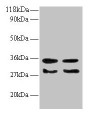 Western Blot, All lanes: TGFA antibody at 2ug/ml, Lane 1: EC109 whole cell lysate, Lane 2: 293T whole cell lysate, Secondary, Goat polyclonal to rabbit IgG at 1/15000 dilution, Predicted band size: 18, 17 kDa, Observed band size: 30, 35 kDa