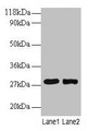 Western Blot, All lanes: MPZ antibody at 2ug/ml, Lane 1: 293T whole cell lysate, Lane 2: EC109 whole cell lysate, Secondary, Goat polyclonal to rabbit IgG at 1/15000 dilution, Predicted band size: 28, 35 kDa, Observed band size: 28 kDa