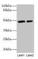 Western Blot, All lanes: CALR antibody at 2ug/ml, Lane 1: EC109 whole cell lysate, Lane 2: 293T whole cell lysate, Secondary, Goat polyclonal to rabbit IgG at 1/10000 dilution, Predicted band size: 49 kDa, Observed band size: 49 kDa
