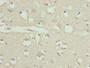 Immunohistochemistry of paraffin-embedded human brain tissue using CAC14105 at dilution of 1:100