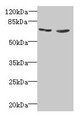 Western Blot, All lanes: TNFRSF11A antibody at 2ug/ml, Lane 1: EC109 whole cell lysate, Lane 2: 293T whole cell lysate, Secondary, Goat polyclonal to rabbit IgG at 1/15000 dilution, Predicted band size: 67, 33, 37, 29, 57, 65 kDa, Observed band size: 67 kDa