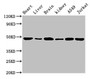 Western Blot, Positive WB detected in: Mouse heart tissue, Mouse liver tissue, Mouse brain tissue, Mouse kidney tissue, A549 whole cell lysate, Jurkat whole cell lysate, All lanes: ENO2 antibody at 1.5ug/ml, Secondary, Goat polyclonal to rabbit IgG at 1/10000 dilution, Predicted band size: 48, 43 kDa, Observed band size: 48 kDa