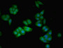 Immunofluorescent analysis of HepG2 cells using CAC14118 at dilution of 1:100 and Alexa Fluor 488-congugated AffiniPure Goat Anti-Rabbit IgG(H+L)
