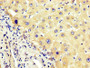IHC image of CAC14118 diluted at 1:400 and staining in paraffin-embedded human liver tissue performed on a Leica BondTM system. After dewaxing and hydration, antigen retrieval was mediated by high pressure in a citrate buffer (pH 6.0). Section was blocked with 10% normal goat serum 30min at RT. Then primary antibody (1% BSA) was incubated at 4°C overnight. The primary is detected by a biotinylated secondary antibody and visualized using an HRP conjugated SP system.