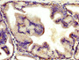 IHC image of CAC14118 diluted at 1:400 and staining in paraffin-embedded human prostate tissue performed on a Leica BondTM system. After dewaxing and hydration, antigen retrieval was mediated by high pressure in a citrate buffer (pH 6.0). Section was blocked with 10% normal goat serum 30min at RT. Then primary antibody (1% BSA) was incubated at 4°C overnight. The primary is detected by a biotinylated secondary antibody and visualized using an HRP conjugated SP system.