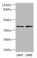 Western Blot, All lanes: DCN antibody at 2ug/ml, Lane 1: Mouse heart tissue, Lane 2: HepG2 whole cell lysate, Secondary, Goat polyclonal to rabbit IgG at 1/10000 dilution, Predicted band size: 40, 28, 24, 20, 9 kDa, Observed band size: 40 kDa