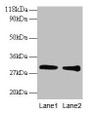 Western Blot, All lanes: GSTP1 antibody at 2ug/ml, Lane 1: EC109 whole cell lysate, Lane 2: 293T whole cell lysate, Secondary, Goat polyclonal to rabbit IgG at 1/15000 dilution, Predicted band size: 24 kDa, Observed band size: 30 kDa
