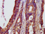 IHC image of CAC14122 diluted at 1:500 and staining in paraffin-embedded human colon cancer performed on a Leica BondTM system. After dewaxing and hydration, antigen retrieval was mediated by high pressure in a citrate buffer (pH 6.0). Section was blocked with 10% normal goat serum 30min at RT. Then primary antibody (1% BSA) was incubated at 4°C overnight. The primary is detected by a biotinylated secondary antibody and visualized using an HRP conjugated SP system.