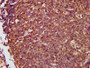 IHC image of CAC14122 diluted at 1:500 and staining in paraffin-embedded human lymph node tissue performed on a Leica BondTM system. After dewaxing and hydration, antigen retrieval was mediated by high pressure in a citrate buffer (pH 6.0). Section was blocked with 10% normal goat serum 30min at RT. Then primary antibody (1% BSA) was incubated at 4°C overnight. The primary is detected by a biotinylated secondary antibody and visualized using an HRP conjugated SP system.